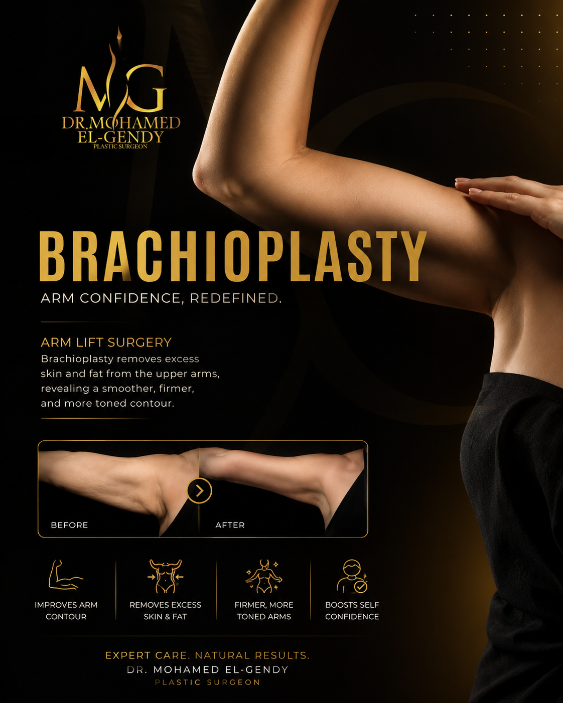 Brachioplasty service